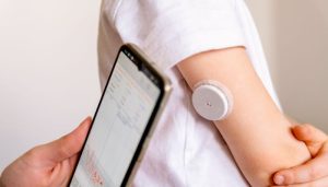 CGM -system of continuous monitoring of glucose on child's arm.